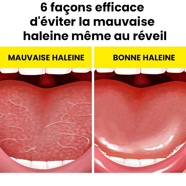 Mauvaise haleine au réveil ? 6 méthodes infaillibles Psicologiaplus — free download